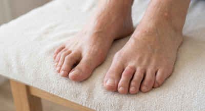 Hammerzehen: Wie erkennt man sie, warum entstehen sie und wie wird man sie wieder los? | ARNO-schuhe.de – Schuhe mit Tradition